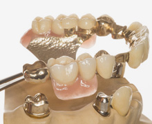 Prothetik - Zahnersatz Zahnärzte in der Wasserburg
